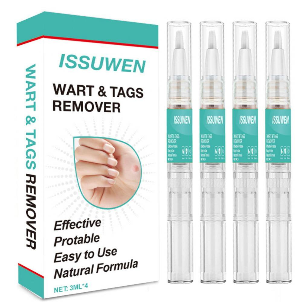 Remover Fast Remove All Moles Warts Spots Freckles anti Foot Corn Removal Warts Papillomas Rapidly Removes Moles