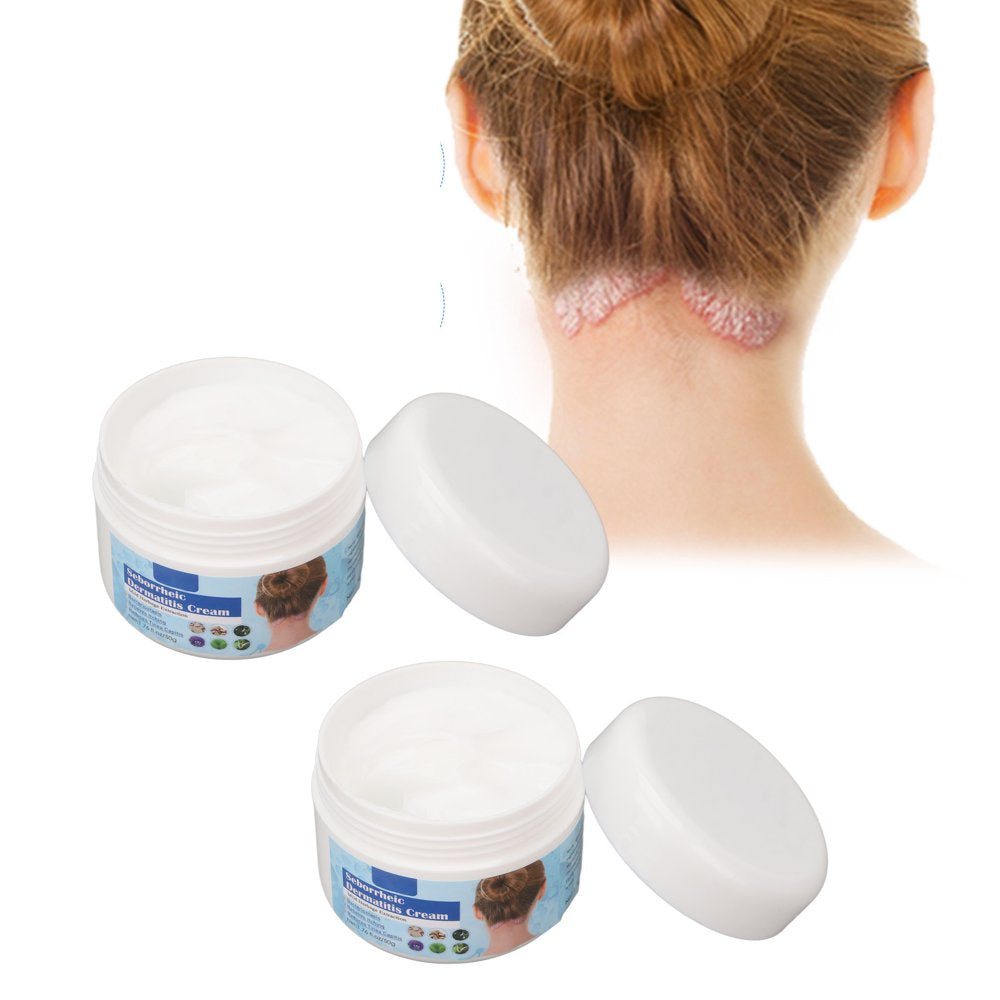 Seborrheic Dermatitis Cream, Scalp Treatment Cream 2Pcs Mild 1.8Oz Reduce Itching for Dry Skin