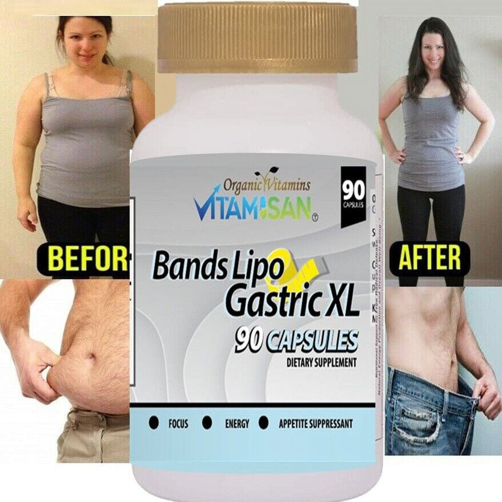 Bands Lipo Gastric Xl Weight Lose Fast Slimming Burn Fat -90 Capsule