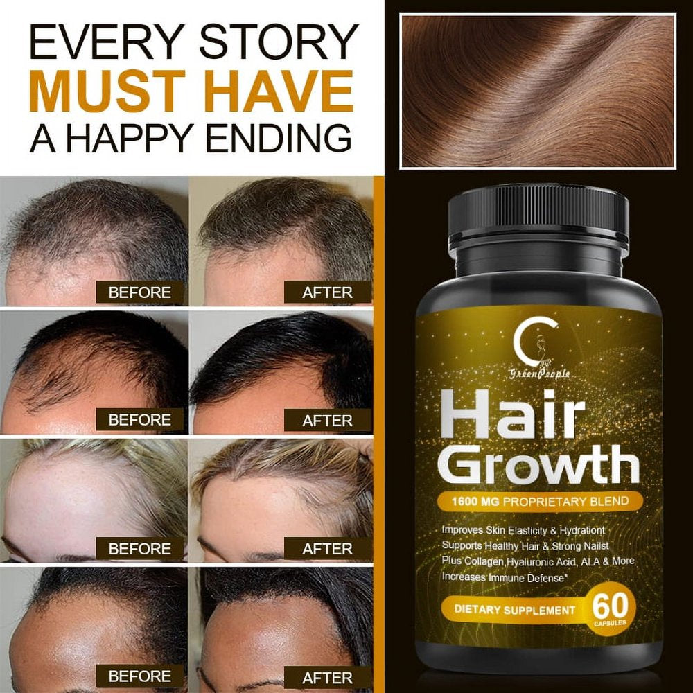 Women Hair Growth Supplement by GPGP Greenpeople, for Thicker, Stronger Hair - 60 Capsules Total - 1 Month Supply