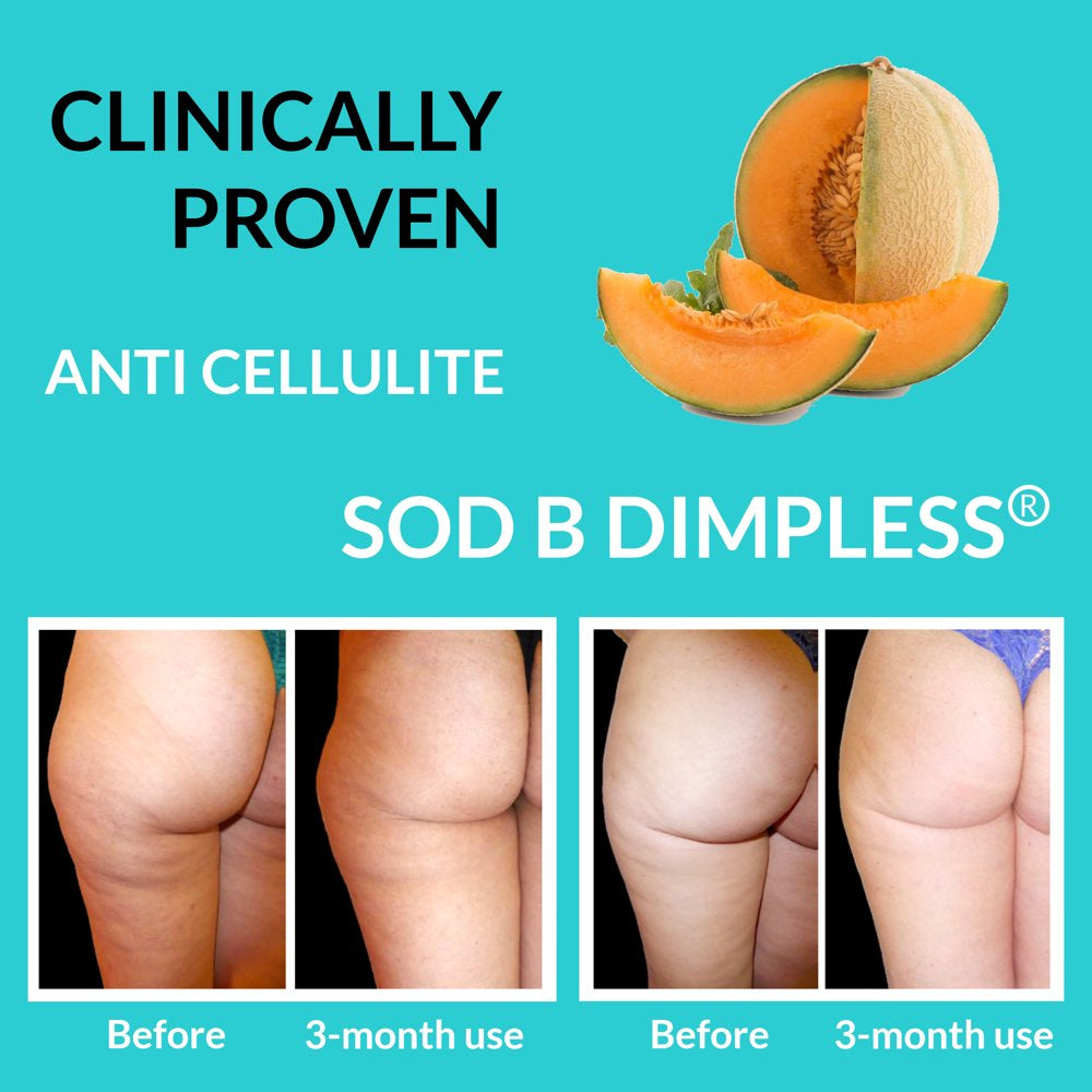 Clinically Proven Cellulite Remover - Varicose Veins Treatment, Restless Leg Relief, Leg Circulation, anti Cellulite Supplements - Caviar Collagen, SOD, Butchers Broom & Horse Chestnut Capsules, 90 Ct