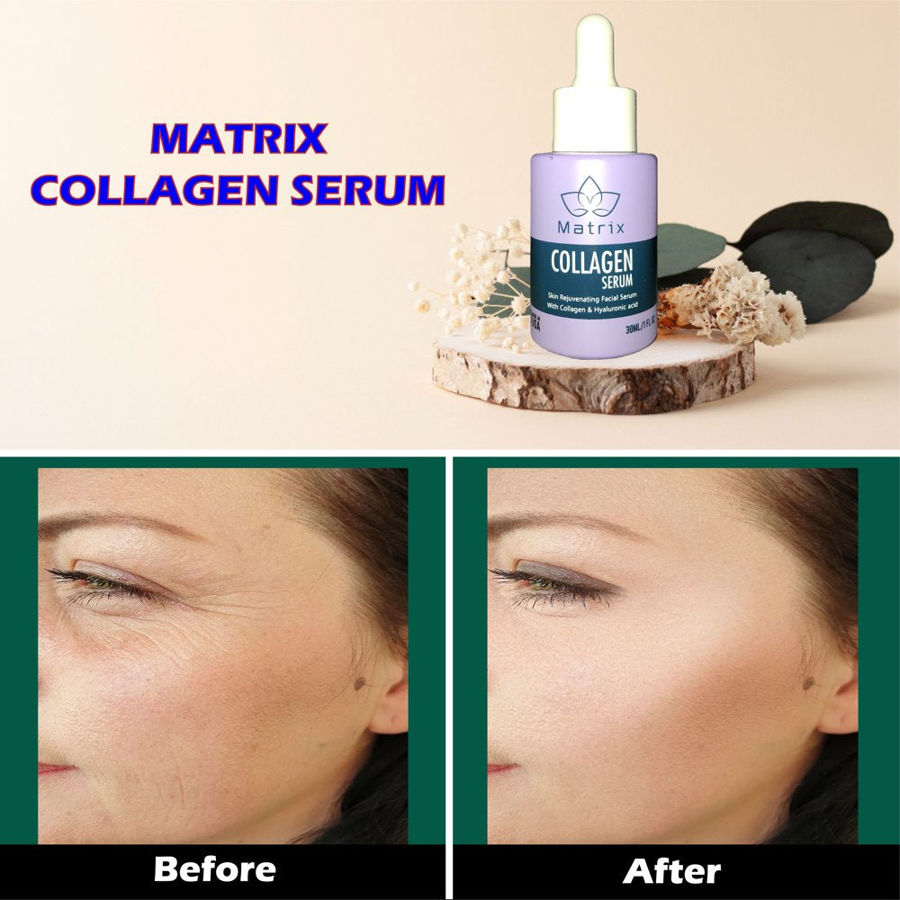 Matrix Collagen Serum for All Skin Types, Anti-Aging, Bright, Smooth, Hydrates