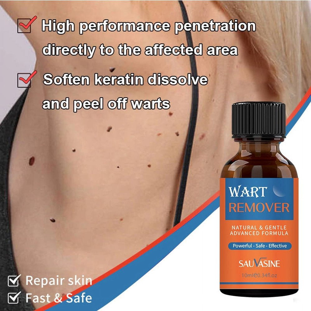 Wart Remover,Gentle Wart Remover, Maximum Strength, Painlessly Removes Plantar Neck, Hands, Back, Advanced Liquid Gel Formula