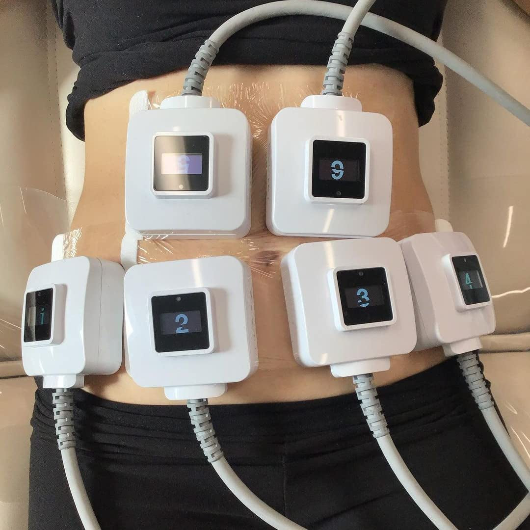 Trusculpt ID Fat Dissolving Machine 3D Monopolar Contouring Body Sculpting Fat Reduction